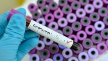 Coronavirus: Keine Verdachtsfälle im Kreis Paderborn (Stand: 28.2.)